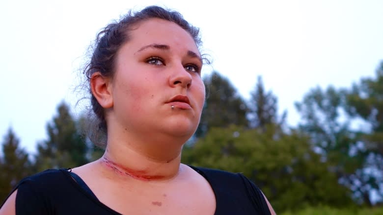 ATV-riding teen survives close call with cable on west Quebec trail