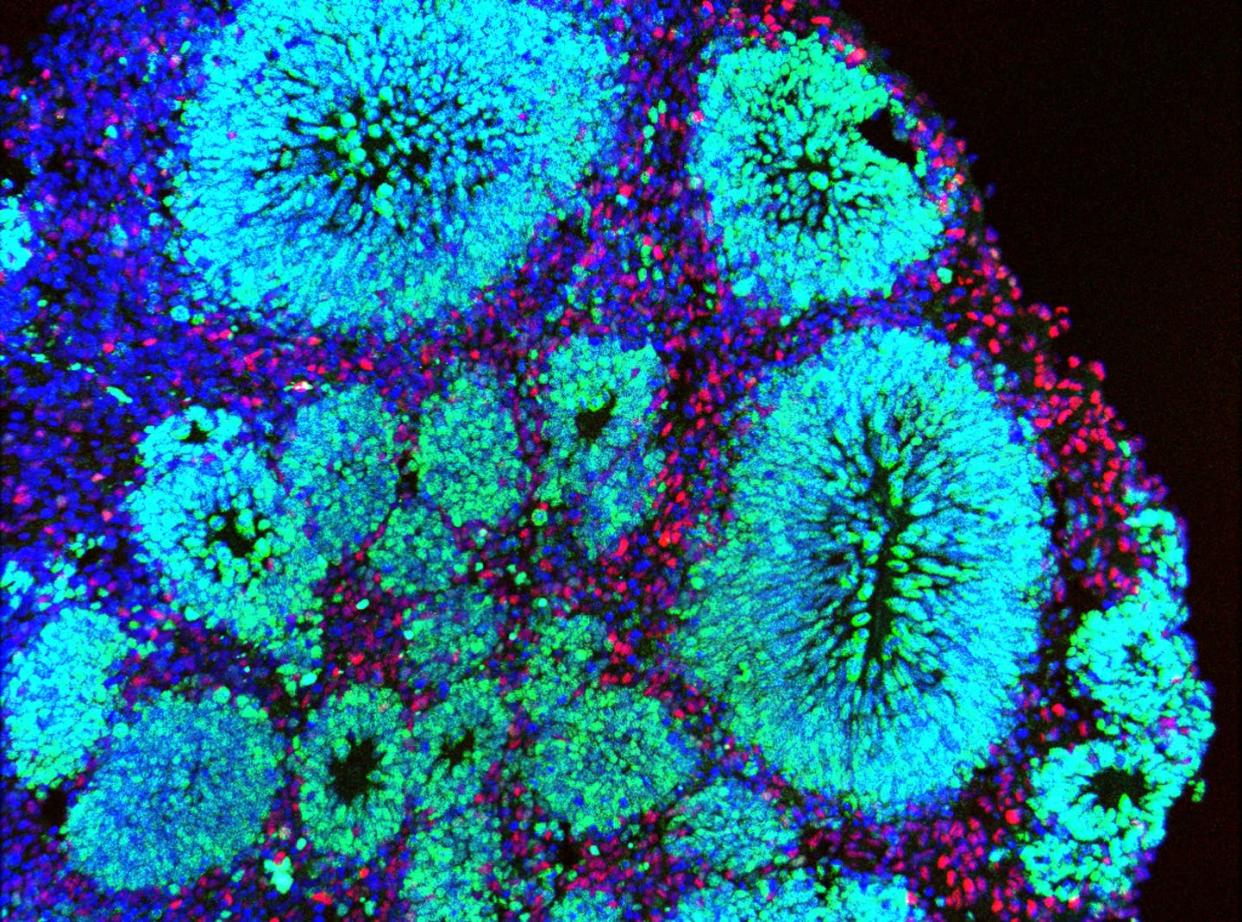 <span class="caption">Just a few millimeters across, organoids are clumps of cells that resemble the brain. </span> <span class="attribution"><span class="source">Madeline Andrews, Arnold Kriegstein's lab, UCSF</span>, <a class="link " href="http://creativecommons.org/licenses/by-nd/4.0/" rel="nofollow noopener" target="_blank" data-ylk="slk:CC BY-ND;elm:context_link;itc:0;sec:content-canvas">CC BY-ND</a></span>
