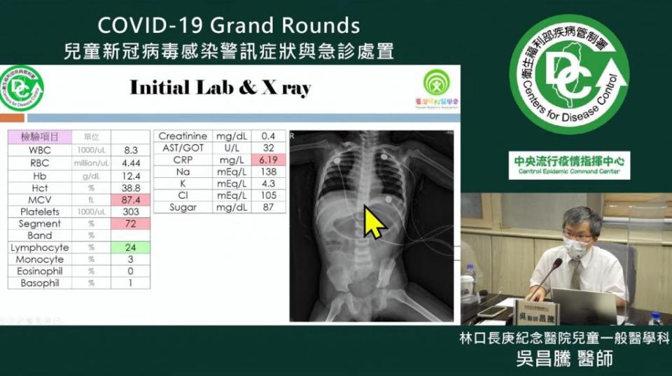 吳昌騰指出，1名9月大的男童出現哮吼症狀，且胸骨一度凹陷。（圖／翻攝自YouTube）