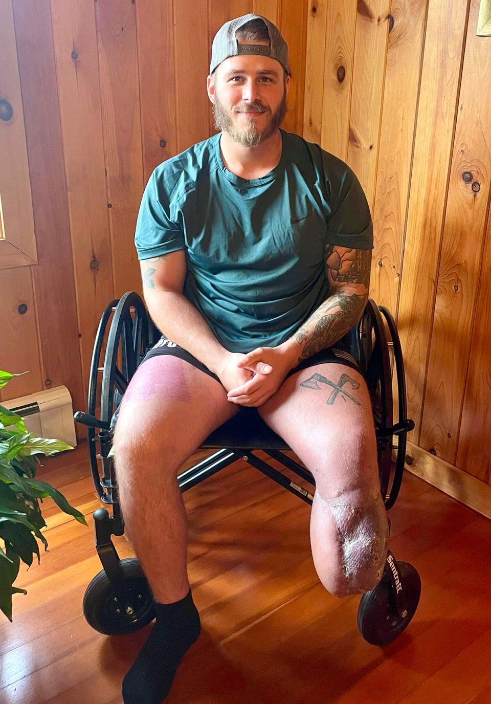 Honesdale High School grad and National Guardsman Logan Freiermuth is making a remarkable recovery from a terrible workplace accident that nearly cost him his life.