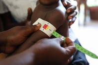 The arm measurement of a child is marked red, meaning severe malnourishment, at St. Luke Hospital in Port-au-Prince