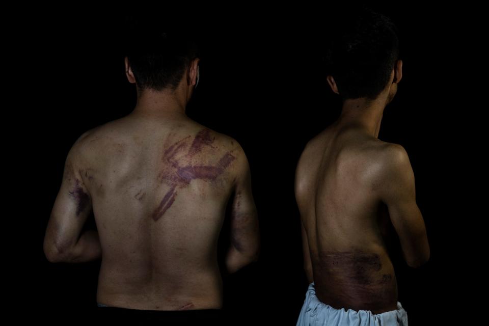 Afghan journalists Neamatullah Naqdi, 28, and Taqi Daryabi, 22, pose for a portrait at Etilaat Roz daily office in Kabul, Afghanistan, Friday, Sept. 10, 2021. The Afghan reporters were detained and beaten by Taliban forces after covering a women's protest in Kabul.  The U.N. human rights office said incidents of Taliban violence against protesters and journalists is increasing.