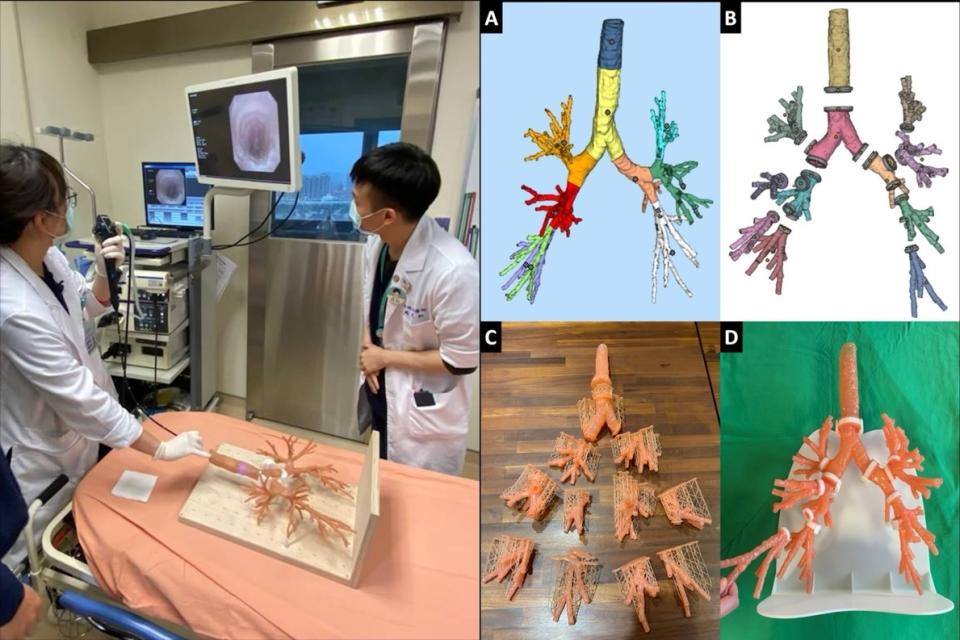 趙克耘製作的「3D支氣管樹」刊登在國際醫學期刊上，說明如何列印出3D支氣管樹（圖右），使用支氣管鏡得到的影像十分逼真（圖左）。圖／引用自「呼吸照護。Respir Care 2023;68(4)_527-530.」
