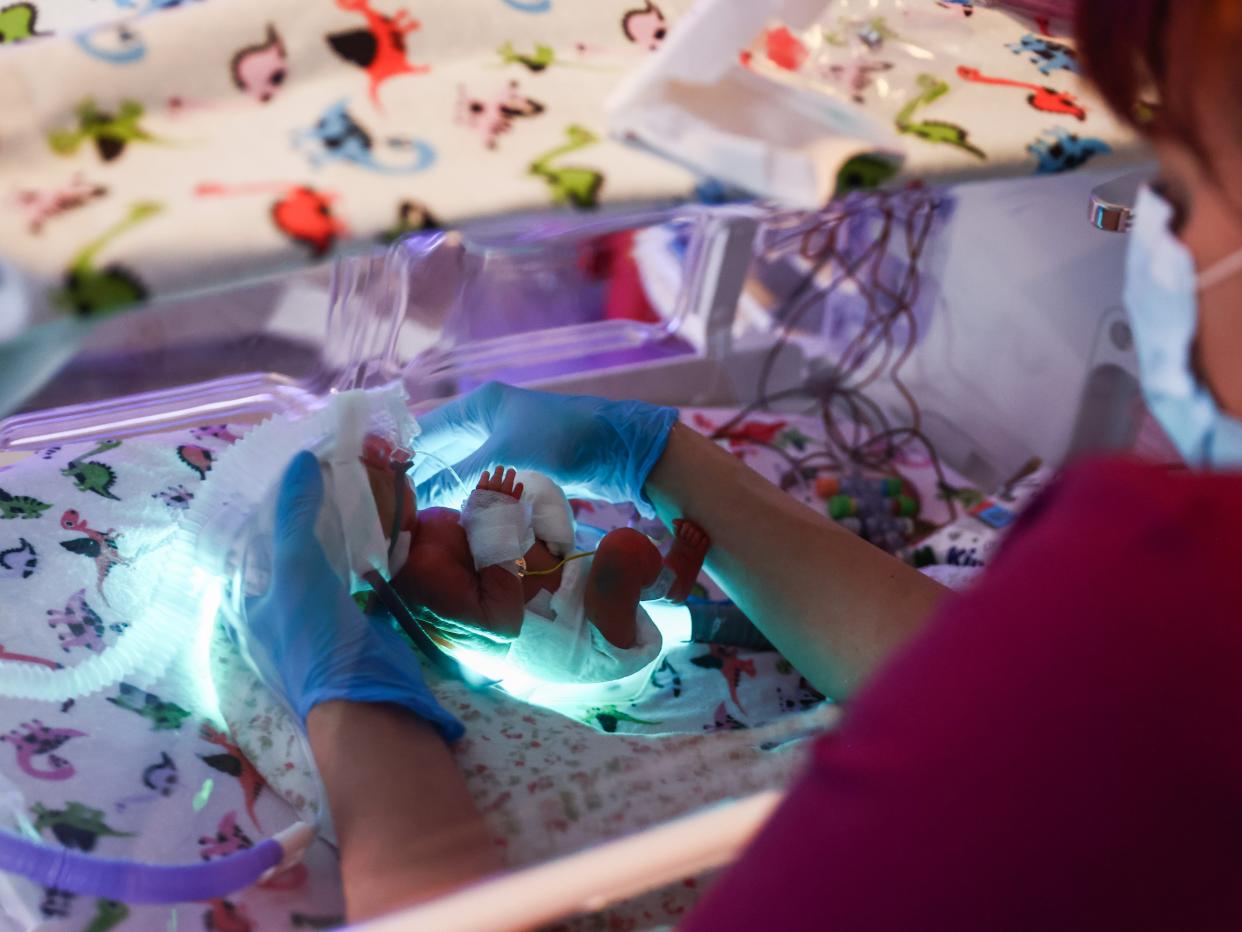 One of the quintuplets being taken care by a nurse