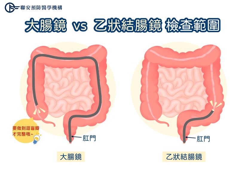 完整的大腸鏡檢查很重要，不要只檢查到一半。（圖／聯安預防醫學機構提供）