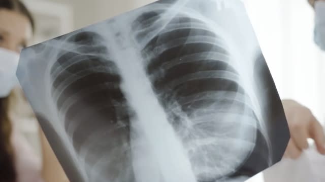 Chest x-ray