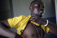 Nicholas Okpe, a commercial bus driver, who says he was shot in the chest during last year’s police brutality protest shows a scar during an interview with The Associated Press in Lagos, Nigeria on Thursday, Oct. 14, 2021. He is among more than 100 Nigerians awaiting a verdict from a panel that is reviewing both the Lekki shooting and allegations of police brutality that inspired the October 2020 protests. (AP Photo/Sunday Alamba)