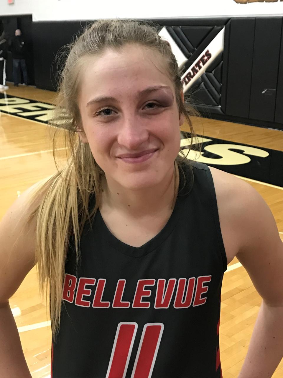 Bellevue's Brynn Vogel sports a swollen eye after a collision.