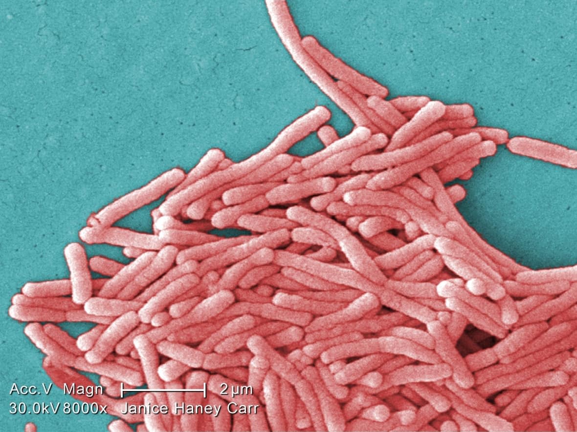 Legionella pneumophila bacteria are seen under an electron microscope. Western Quebec's health authority is reporting six recent cases of legionellosis with no clear source. (Janice Haney Carr/Centers for Disease Control/Associated Press - image credit)