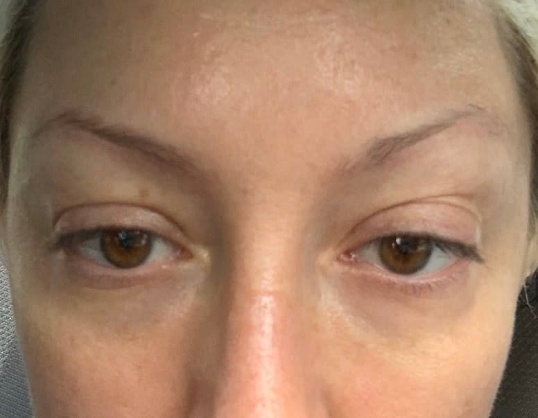 Erin Parson's brows before the procedure