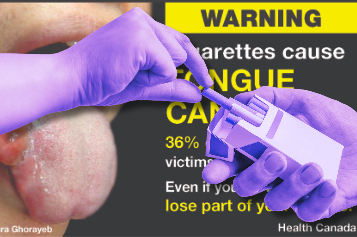 Health Canada is warning smokers about the risk of tongue cancer. (via Canva)