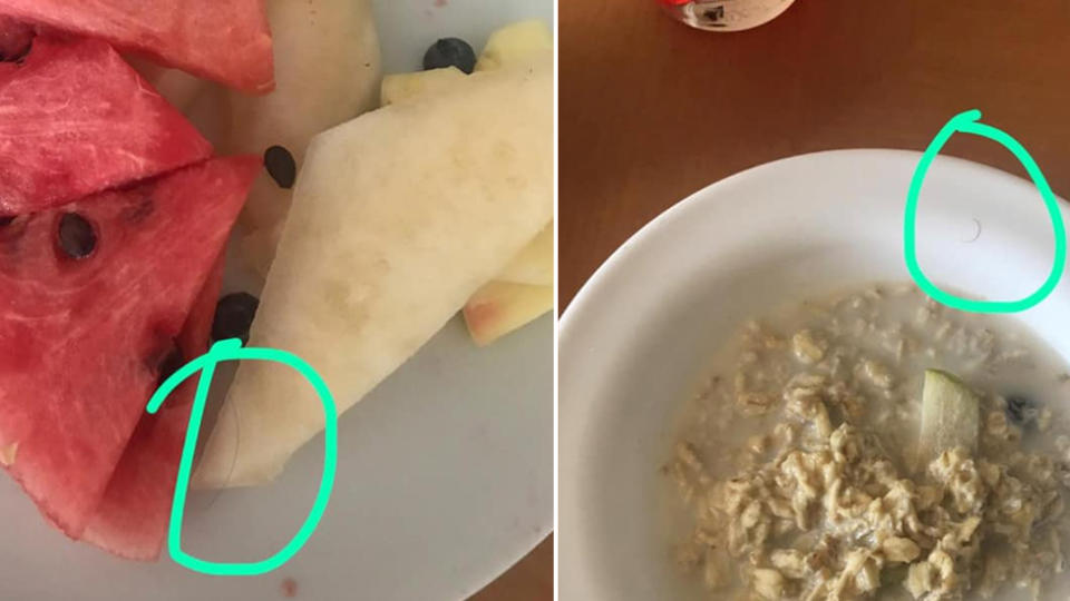 The man posted two images of meals with hairs on the plate. Source: Facebook