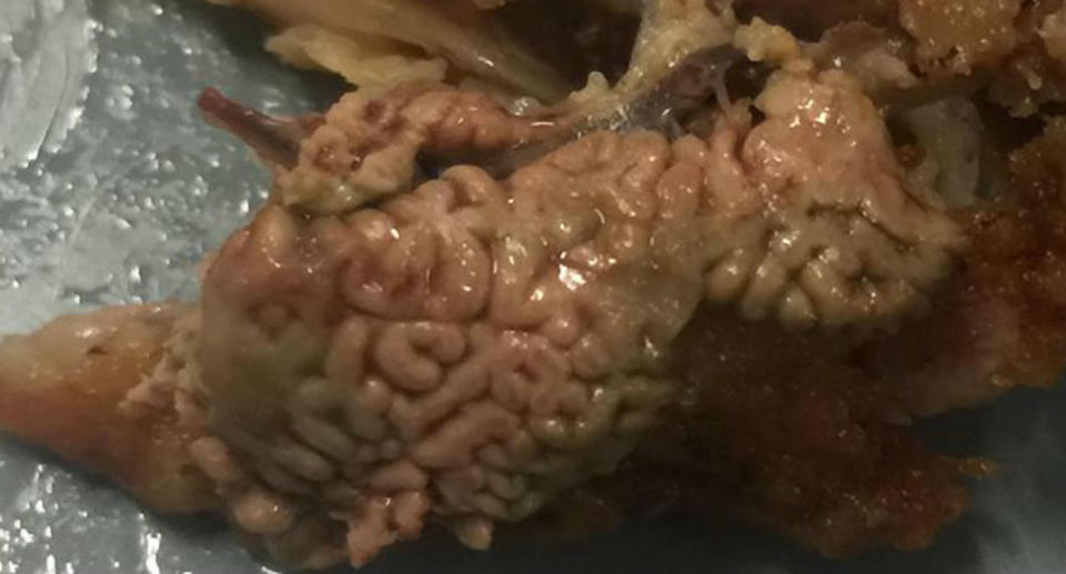 A woman posted a picture of what she believed to be brains in her KFC chicken. Source: Facebook