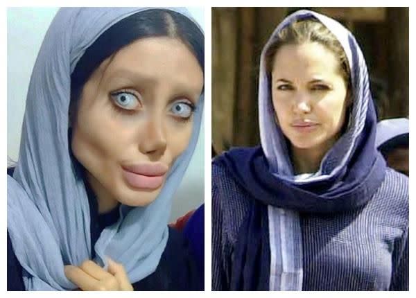 Sahar claims it's her dream to look like Angelina Jolie. Photo: Instagram/Getty