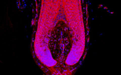 The inside of a human hair bulb - Credit: Nathan John Hawkshaw 