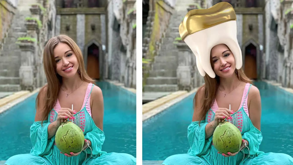  Before and after Photoshopped image of a girl wearing a tooth as a crown. 