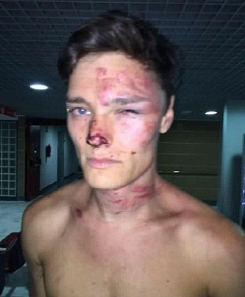 Witnesses took to Facebook to say Mr Henderson was left bruised after the alleged bashing.