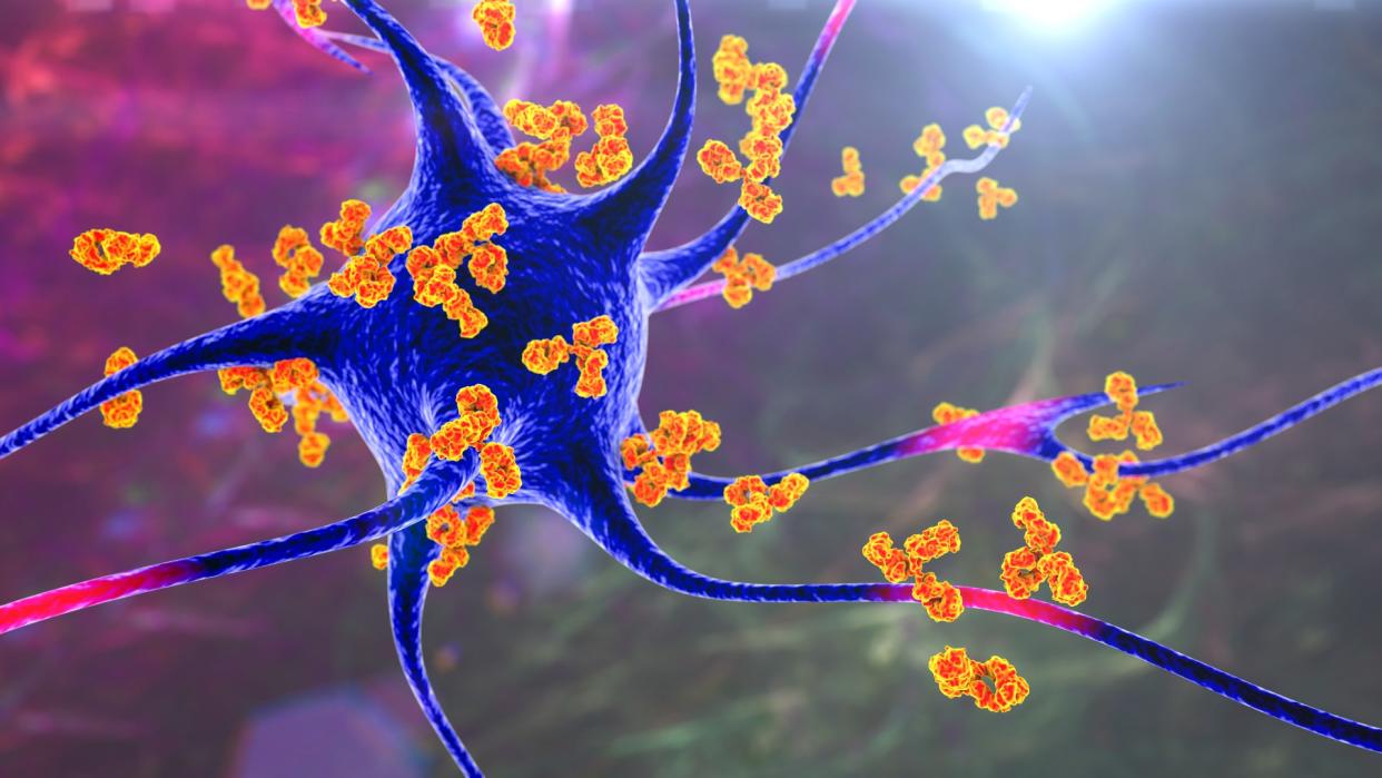  Antibodies depicted in orange latching onto a blue neuron in order to summon immune cells to the site. 