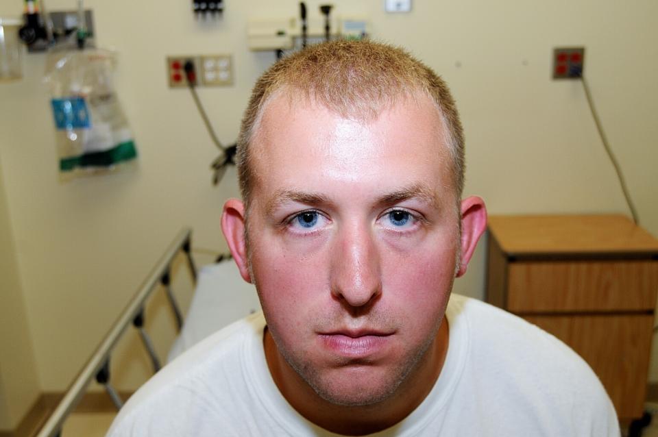 FILE - In this 2014 file photo provided by the St. Louis County Prosecuting Attorney's Office is Ferguson police officer Darren Wilson during his medical examination after he the fatal shooting of Michael Brown. St. Louis County’s top prosecutor announced Thursday, July 30, 3030, that he will not charge Brown, the former police officer who fatally shot Michael Brown in Ferguson, Mo. (St. Louis County Prosecuting Attorney's Office via AP, File)