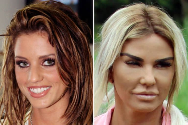 Katie Price luce irreconocible luego de la cantidad de cirugías a las que se sometió.