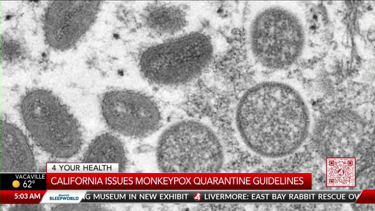 California issues monkeypox quarantine guidelines