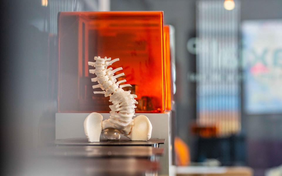 A 3D printed scan of a patient's body made by Axial3D - Axial3D