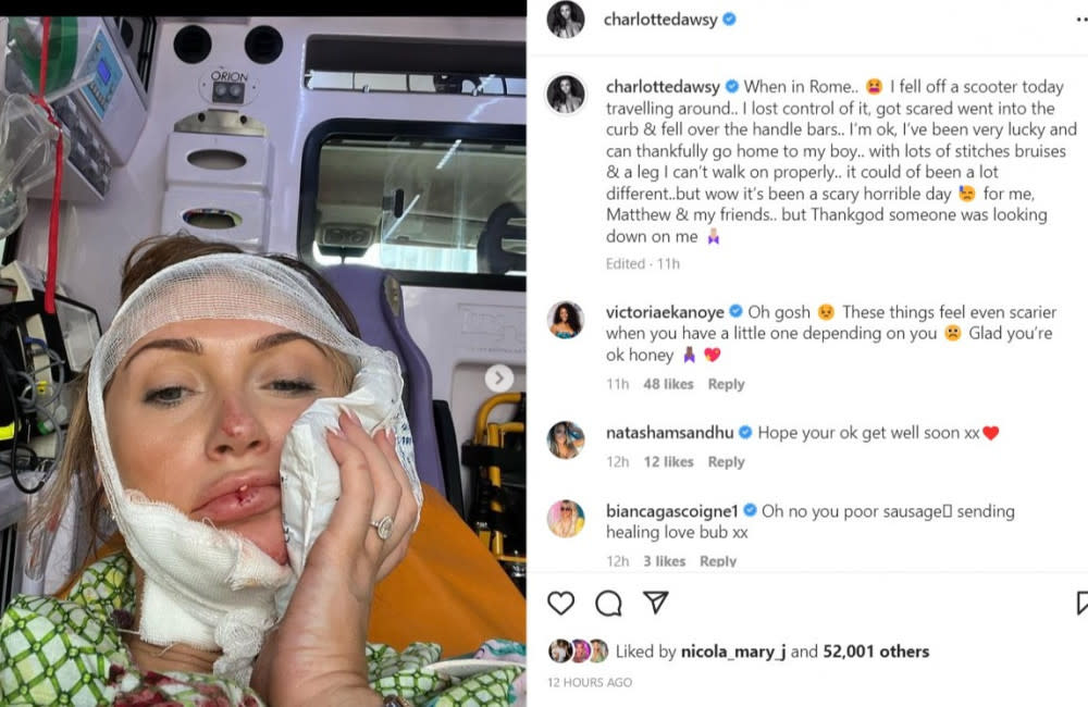 Charlotte Dawson rushed to hospital after 'losing control' of scooter - Instagram credit:Bang Showbiz