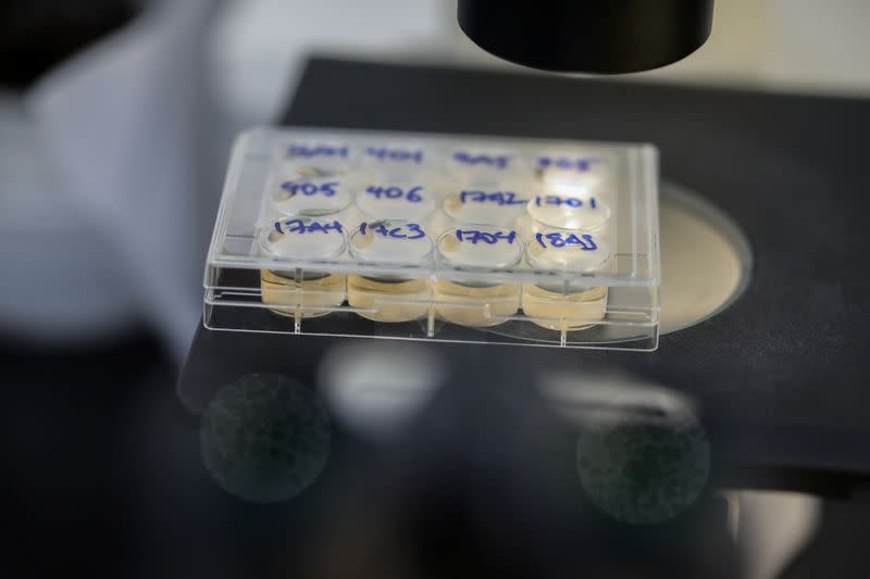 Cells that produce antibodies against the coronavirus disease (COVID-19) are seen under a microscope, in a university lab in Athens