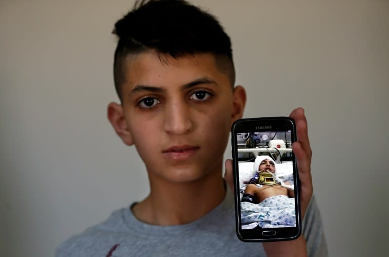 Palestinian teenager Ahmed Abu al-Homs, 13, poses at his family home in east Jerusalem with a mobile phone showing a picture of himself in a hospital's surgery room, where he was treated after being hit by sponge-tipped bullets used by Israeli forces