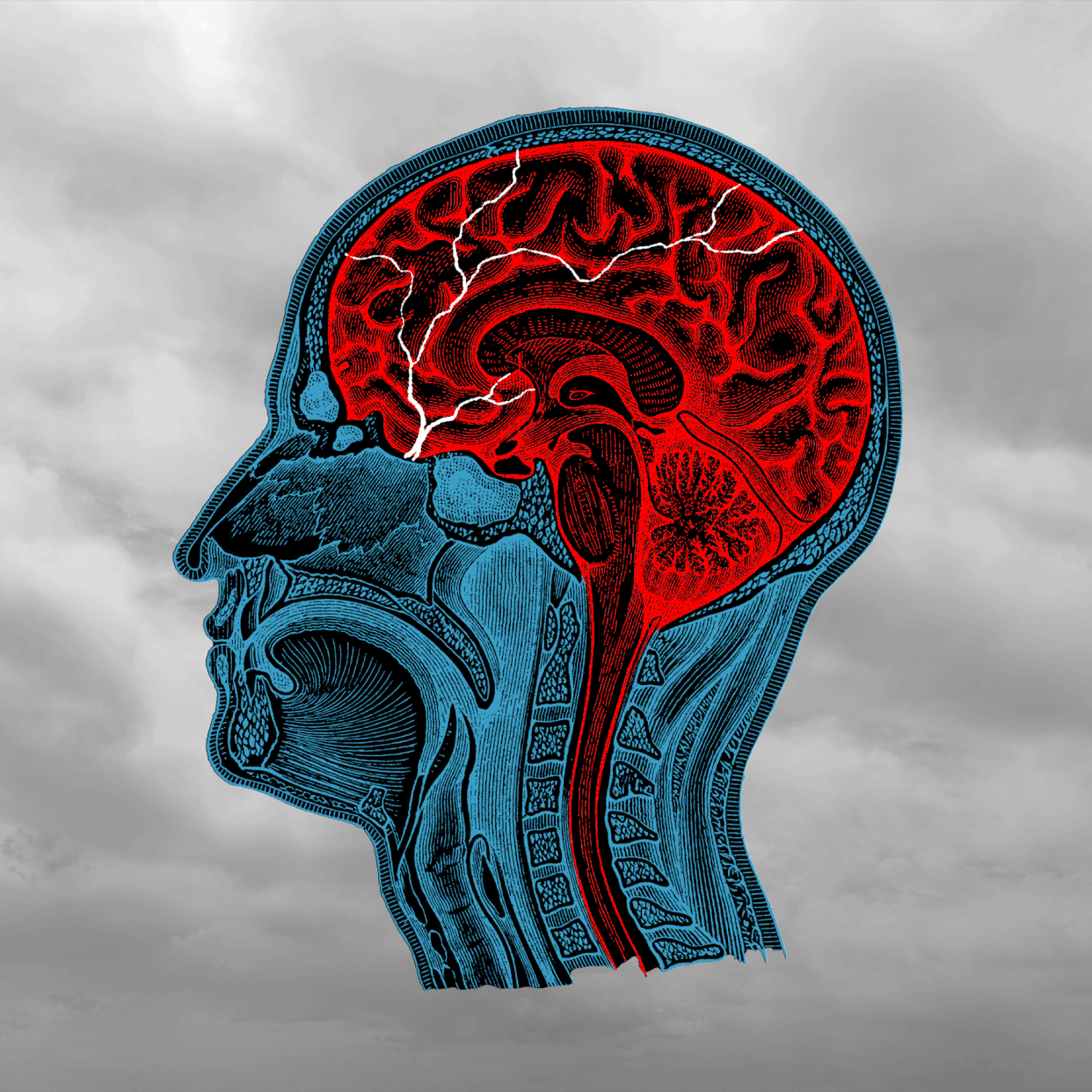 anatomical head showing the interior of the brain with animated lightning and a cloudy sky background