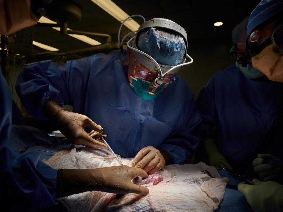 A surgeon in blue scrubs and protective gear leans over an obscured patient on an operating table during a breakthrough transplant procedure