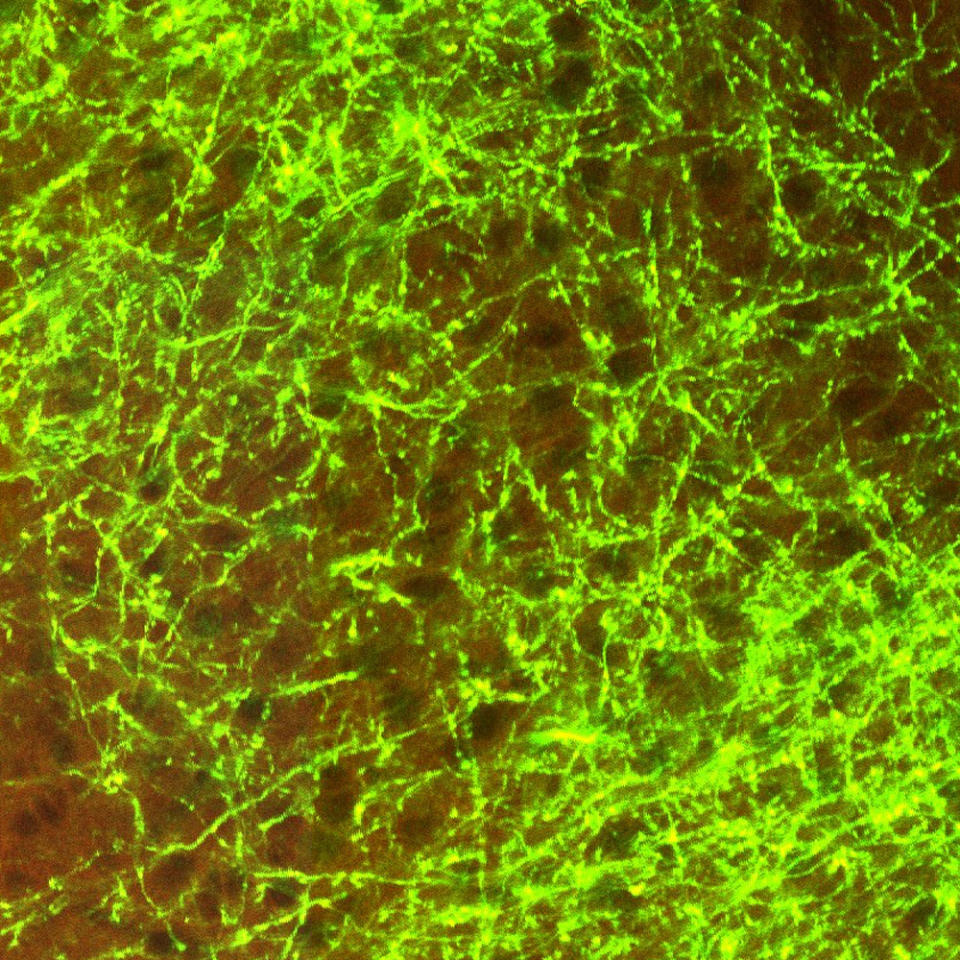 This image provided by the Allen Institute for Brain Science on March 28, 2014 shows a high-resolution view of the dense and highly branched axons from nerve cells making direct connections from the primary somatosensory cortex in the brain of a mouse. Research published Wednesday, April 2, 2014 is the first brain-wide wiring diagram for a mammal at such a level of detail. While it does not reveal every connection between each of the rodent's 75 million brain cells, it shows how parts of the brain are connected. (AP Photo/Allen Institute for Brain Science)