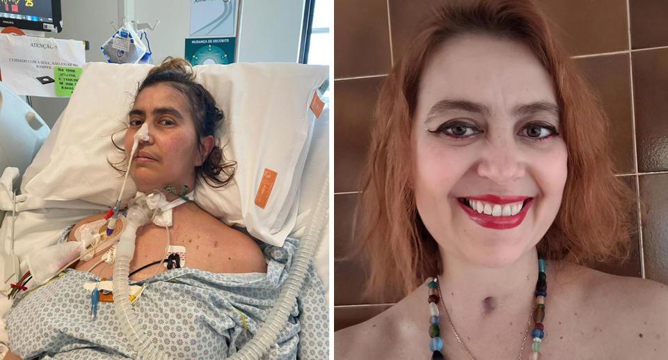 Doralice Carneiro Sobreira Goes in hospital bed after eating contaminated pesto; and smiling after treatment