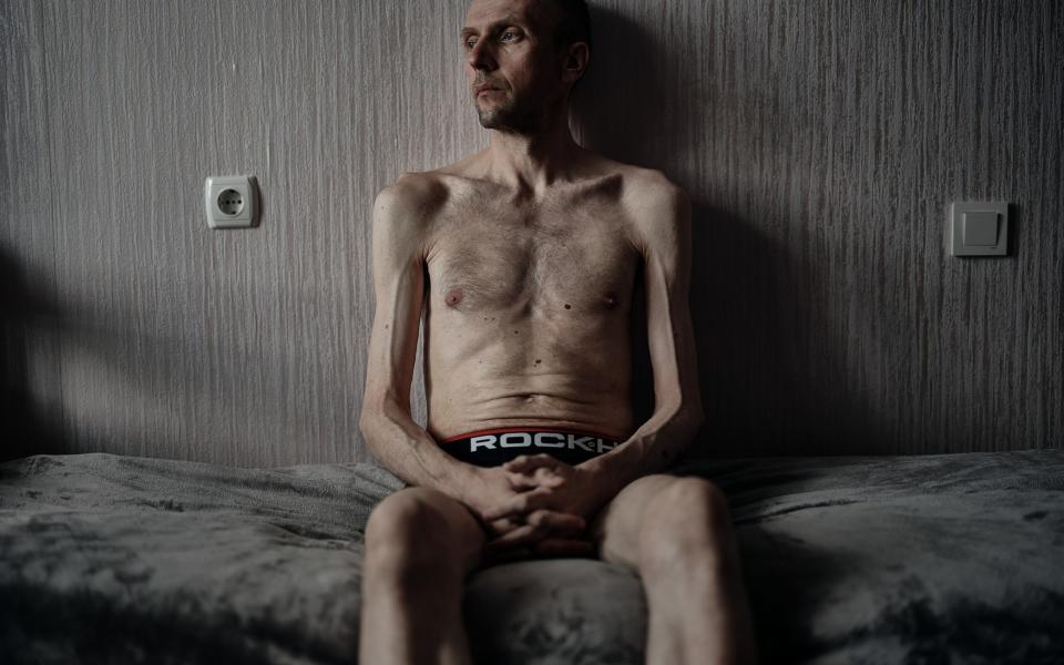 A Ukrainian soldier sits on a bed while undergoing rehabilitation on June 6 in Ukraine.