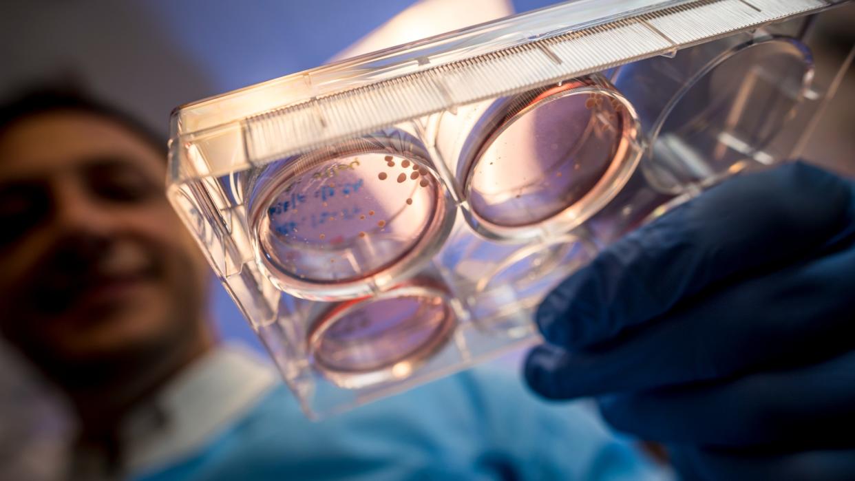  Close-up image of a petri dish containing lab-grown mini brains being held by a scientist wearing blue gloves. The scientist's face can be seen blurred in the background. 