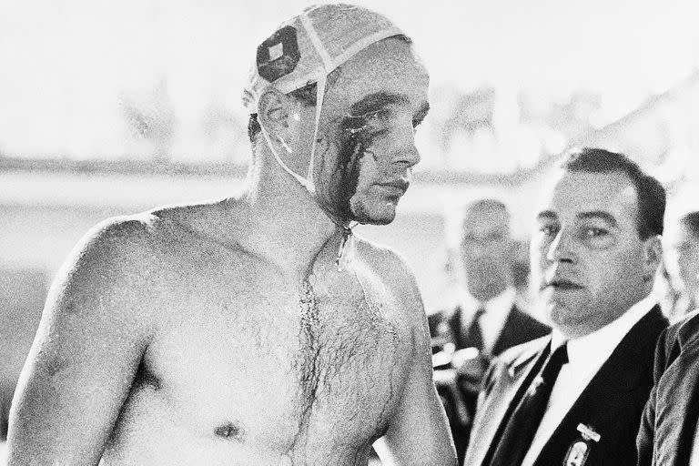 La estrella húngara del waterpolo, Ervin Zador, tras las peleas en los Juegos de Melbourne, en 1956