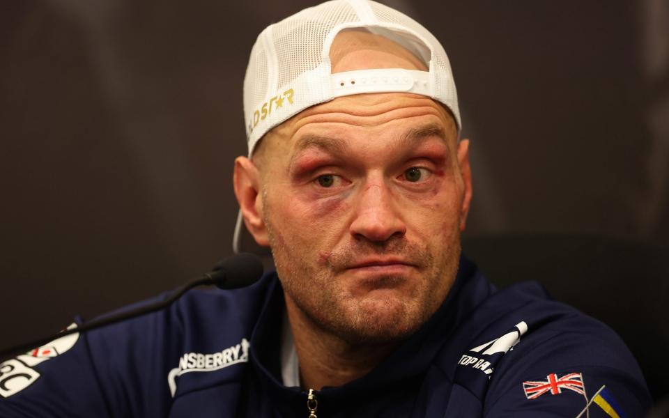 Tyson Fury talks to media