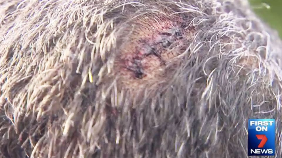 Sidhu was given 10 stitches after the vicious attack. Photo: 7 News