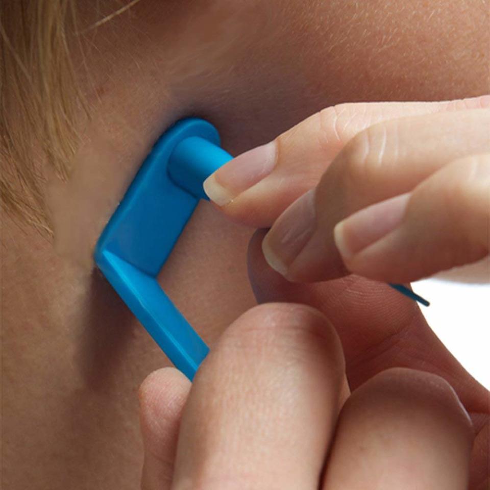 TagBand Skin Tag Removal Device (Photo: Amazon)