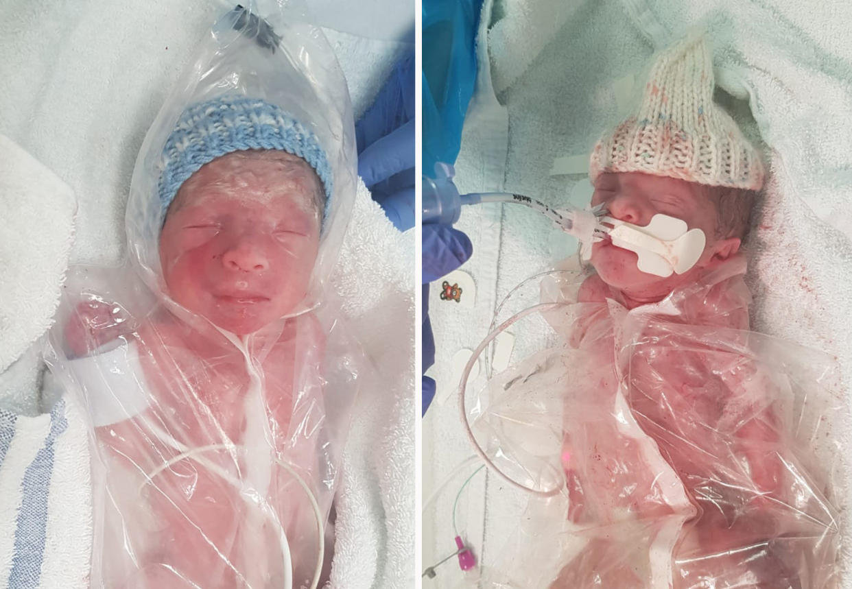 Zaki & Malika in hospital in July 2020 - the miracle twins were popped into 'sandwich bags' to mimic their mother's womb after they arrived three months early (swns)