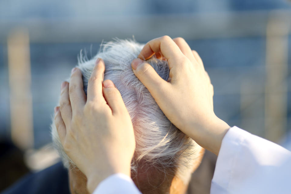 A doctor or dermatologist can help examine your scalp. (Getty Images)