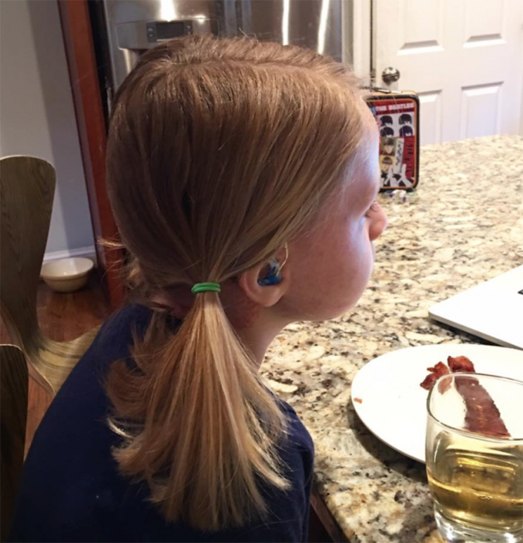 Leo Rose and her pigtails.(Photo: Facebook/Dana Fowle Fox 5)