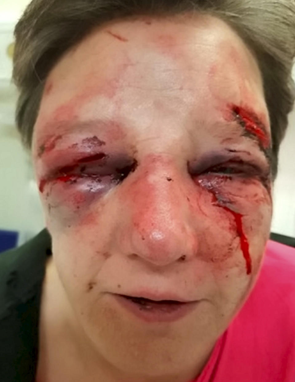 ‘<em>Viciously attacked’ – police said it will take the woman a considerable amount of time to recover (Picture: SWNS)</em>