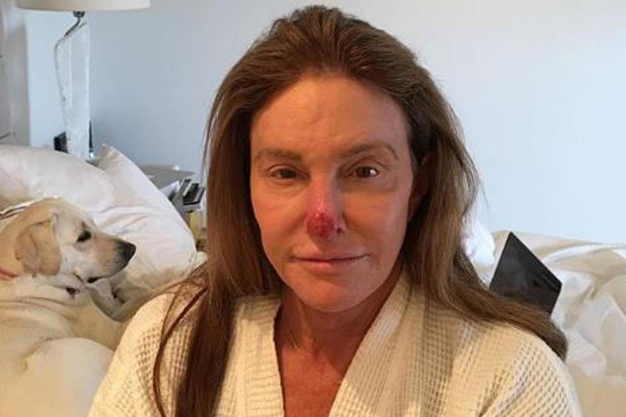 Warning: Jenner prompted her fans not make the same mistake: @caitlynjenner Instagram