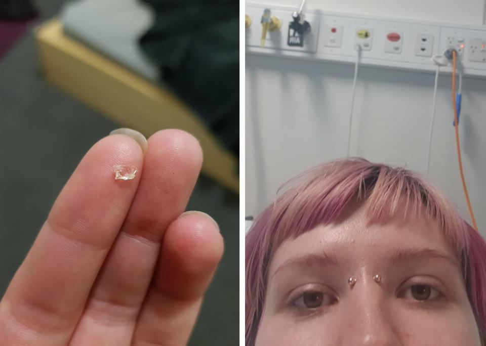 Sarah Crawley spent new year’s day in hospital after swallowing glass she claims was in vegan pasta she bought from her local Woolworths supermarket. Source: Sarah Hazel/ Facebook