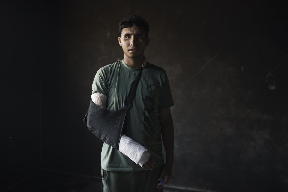 Mohamed Al Masri, who was injured in the recent 11-day war between Israel and Hamas, the militant group that controls Gaza, poses for a photo in his house in Beit Hanoun, northern Gaza Strip, Sunday, June 20, 2021. (AP Photo/Felipe Dana)