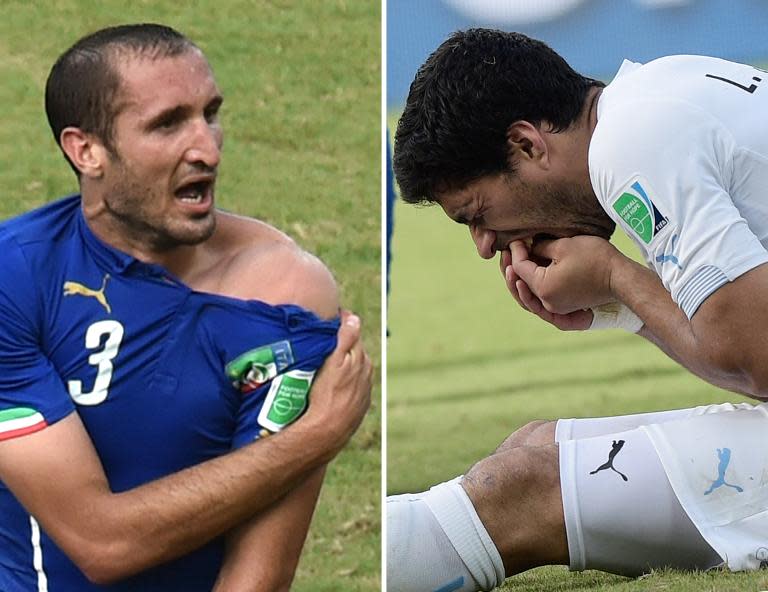 Italy defender Giorgio Chiellini (L) shows an apparent bitemark (L) while Uruguay forward Luis Suarez (R) holds his teeth after the incident on June 24, 2014 in Natal during the Brazil World Cup
