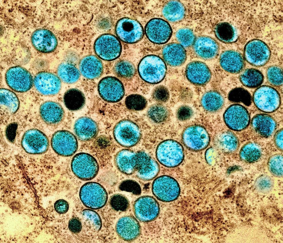 Imagen coloreada de partículas de viruela del mono en una célula infectada (marrón), cultivada en el laboratorio.Crédito: NIAID <a href="https://www.flickr.com/photos/niaid/52103767506/in/album-72177720299215057/" rel="nofollow noopener" target="_blank" data-ylk="slk:Flikr NIAID;elm:context_link;itc:0" class="link ">Flikr NIAID </a>, <a href="http://creativecommons.org/licenses/by-sa/4.0/" rel="nofollow noopener" target="_blank" data-ylk="slk:CC BY-SA;elm:context_link;itc:0" class="link ">CC BY-SA</a>