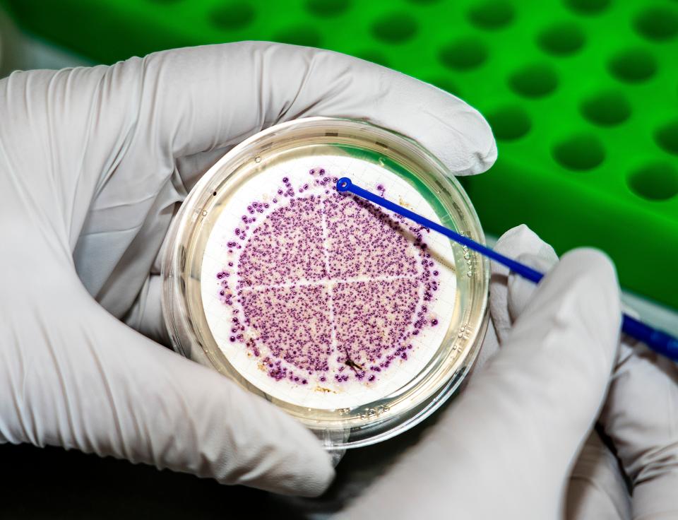 A lab specialist counts the number of E. coli colonies in a lab dish at the University of Wisconsin-Milwaukee's School of Freshwater Sciences as part of a statewide effort to use wastewater to track diseases like COVID, the flu, RSV and others in the population.