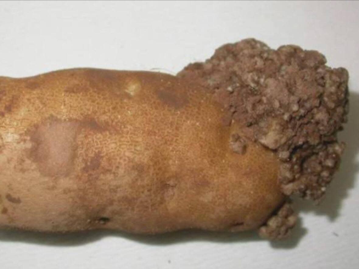 The Canadian Food Inspection Agency suspended fresh P.E.I. potato exports to the U.S after finding potato wart in two Island fields.  (CBC - image credit)